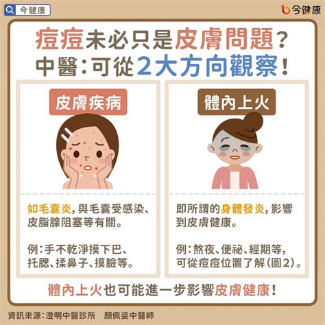 夫妻宮長痘痘|夫妻宮長痘？婚姻恐遇挑戰